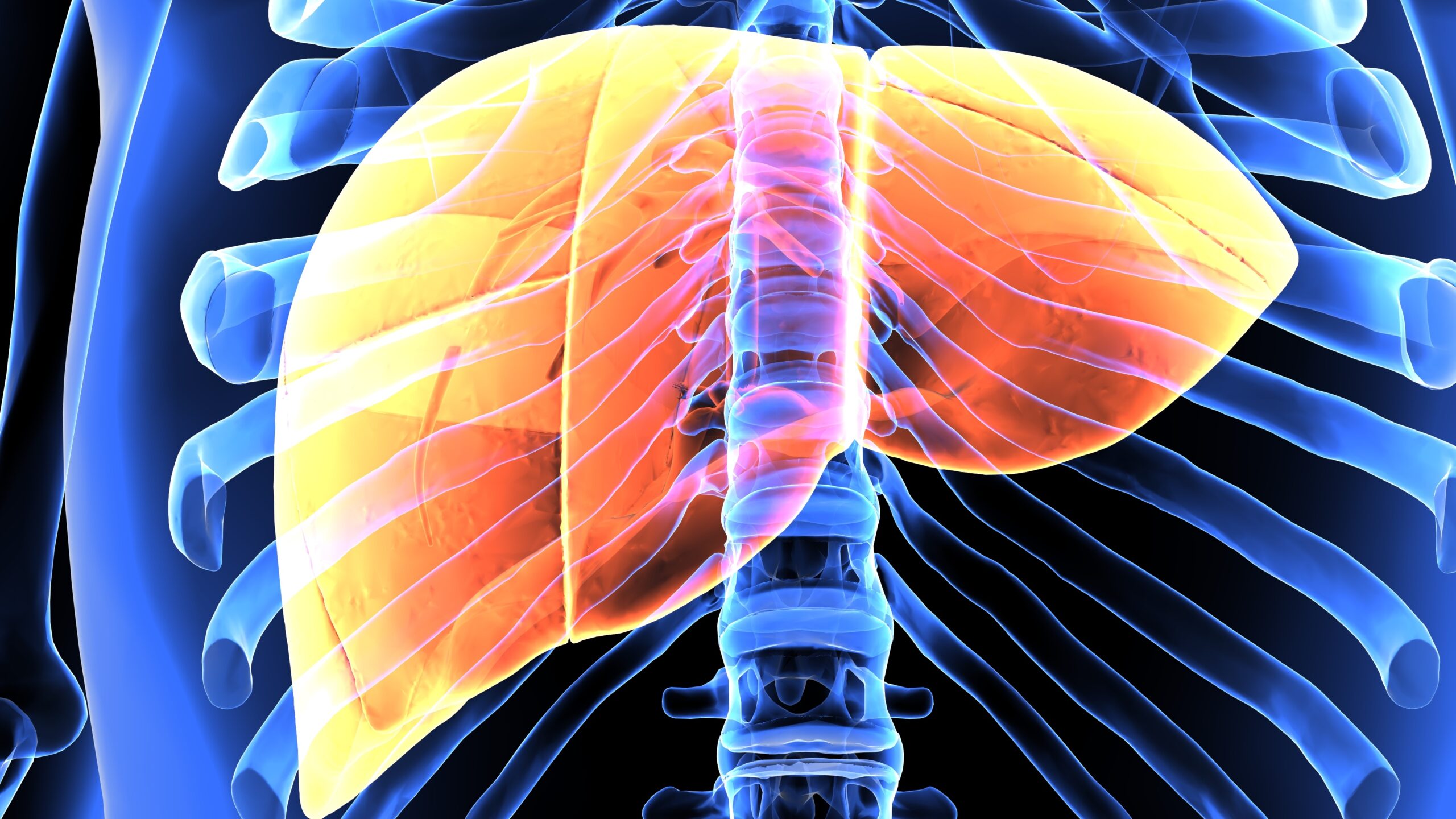 Image of human liver with inflammation or elevated liver functions